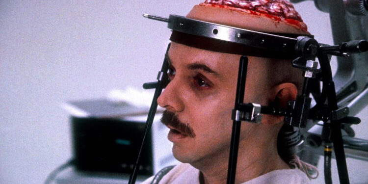 Brain Dead